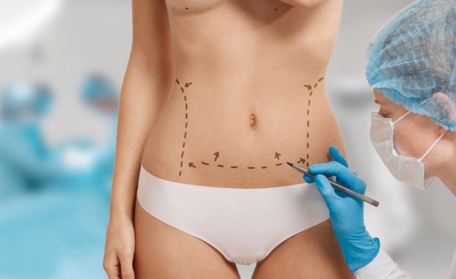 Kiedy warto zdecydować się na liposukcję?